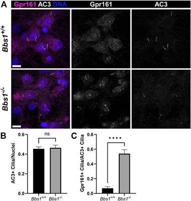 Ciliary signaling proteins are mislocalized in the brains of Bardet-Biedl syndrome 1-null mice